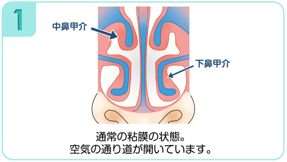 下 鼻甲 介 読み方 上顎骨とは何 Weblio辞書